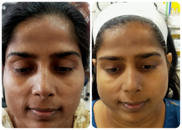 DERMA ONE GOLD SKIN POLISH